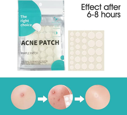 Parches Para Acne DESARROLLADOS CON TECNOLOGÍA HIDROCOLOIDE / PACK X 6 HOJAS